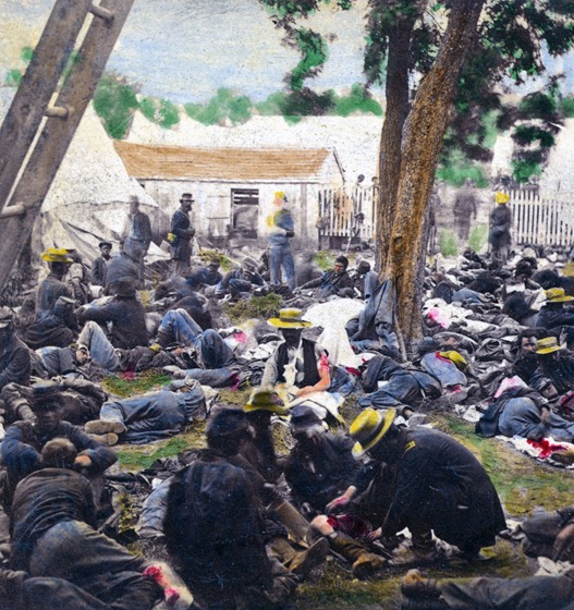 Wounded at Savage’s Station – Hand-colored photo.